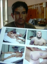 Leonardo Serrano, denuncia como fue golpeado su hijo por la policia de Morteros