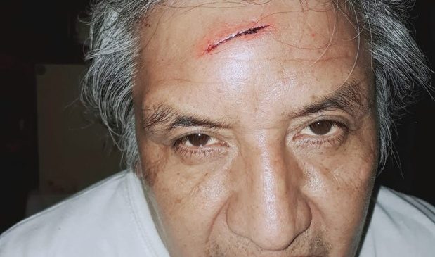 Ataque contra el militante anticarcelario Alfredo Cuellar