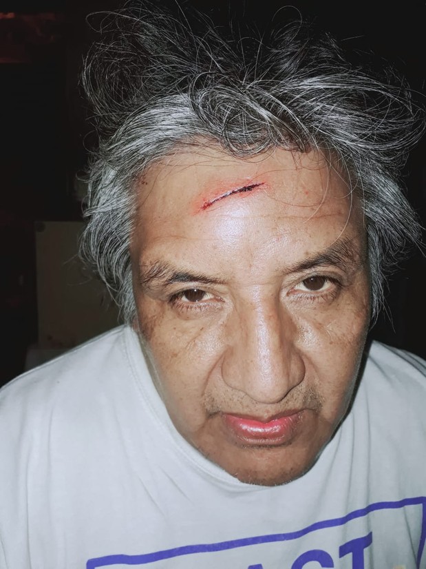 Ataque contra el militante anticarcelario Alfredo Cuellar