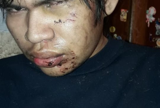 Le destrozaron la cara por ser qom