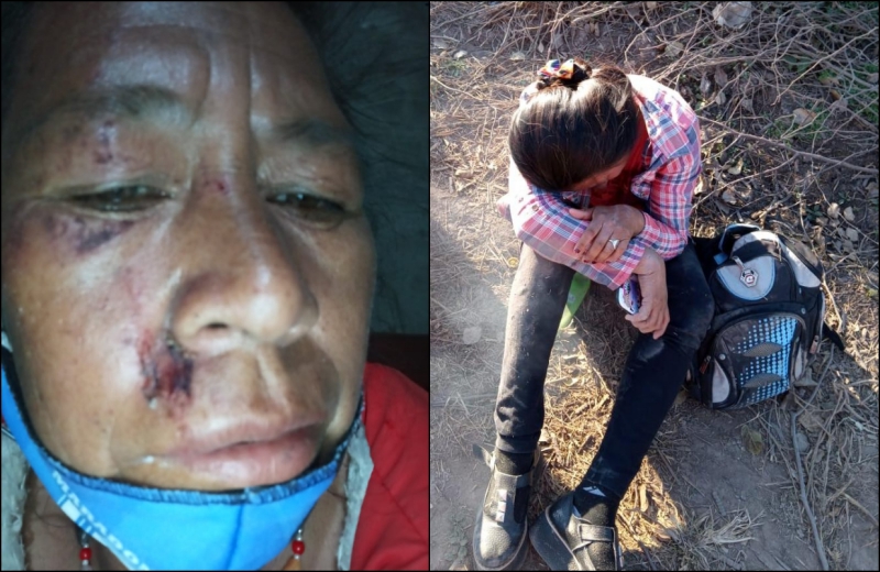 Chaco: grupo racista golpeó brutalmente a dos mujeres indígenas