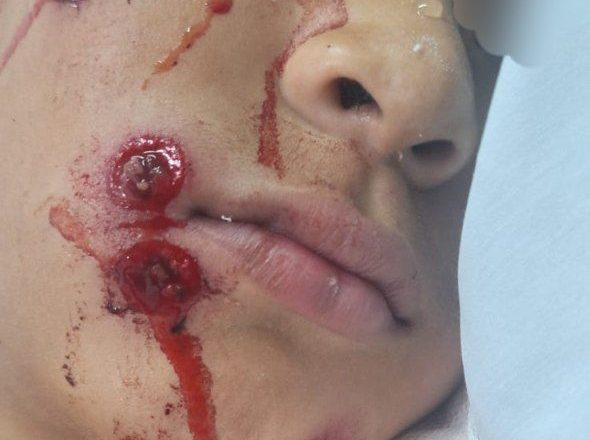Quilmes: represión y un niño baleado por la policía en merendero del Polo Obrero